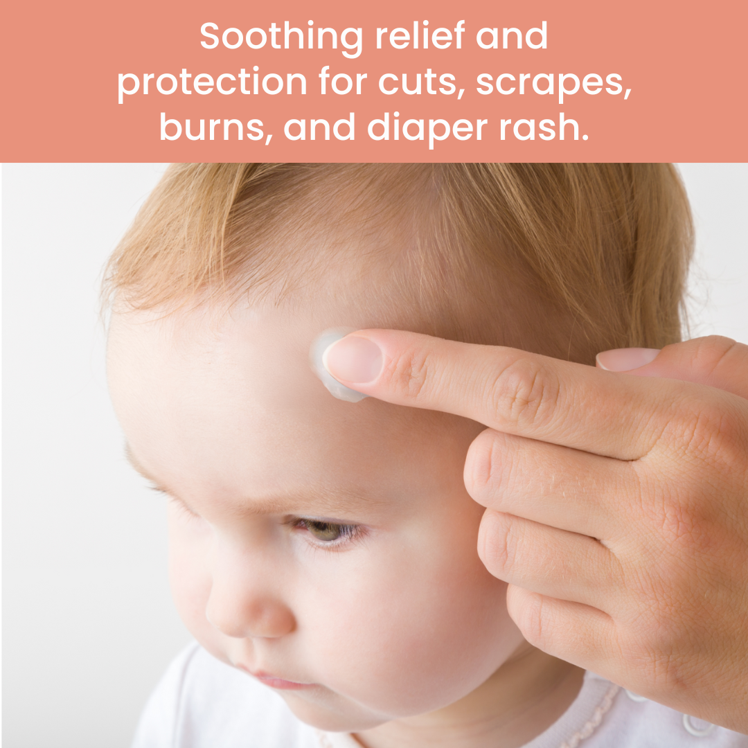 TrueLipids Boo-Boo & Bum Balm: Diaper Rash & Healing Cream for Babies