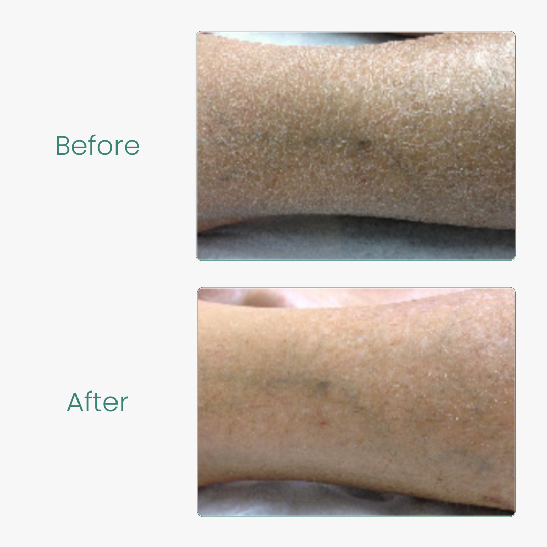 Dry and Itchy Skin Relief Kit