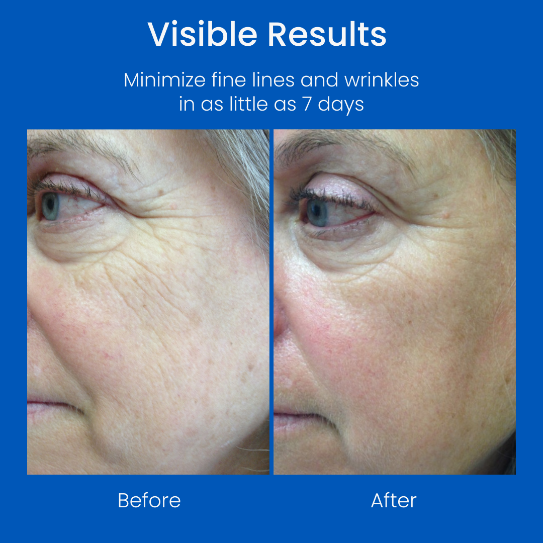 TrueLipids Hydrate, Correct, and Perfect Facial Lotion & Moisturizer (Referral Redemption)