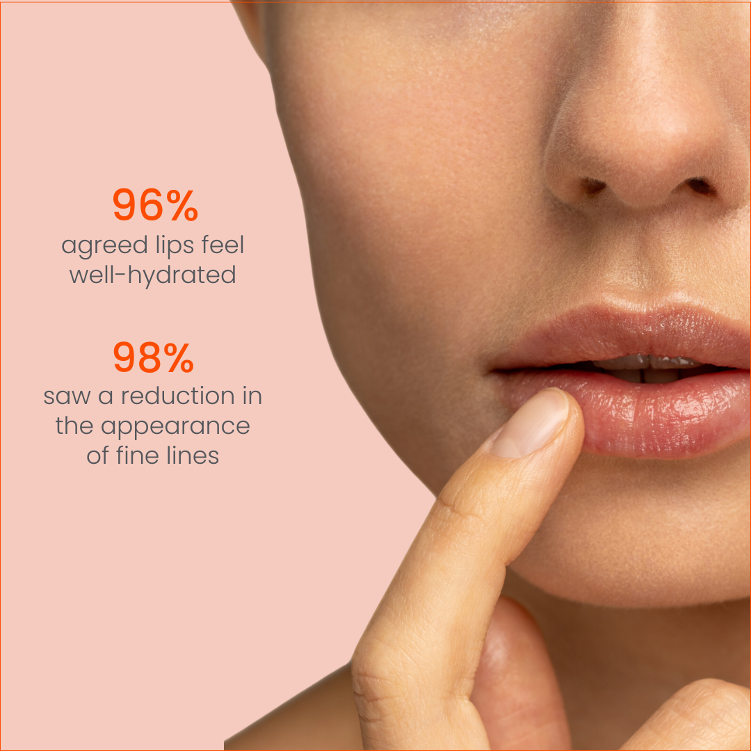 TrueLips Lip Balm: Intensive Lip Moisturizer for Dry, Chapped Lips