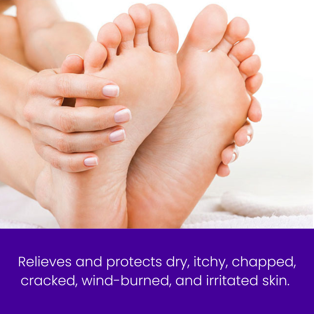 TrueLipids Relieve & Protect Ointment for Dry, Itchy & Eczema-Prone Skin