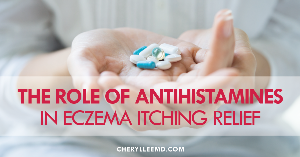 The Role of Antihistamines in the Relief of Eczema Itching