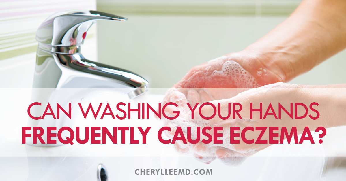 Can Washing Your Hands Too Frequently Cause Eczema?