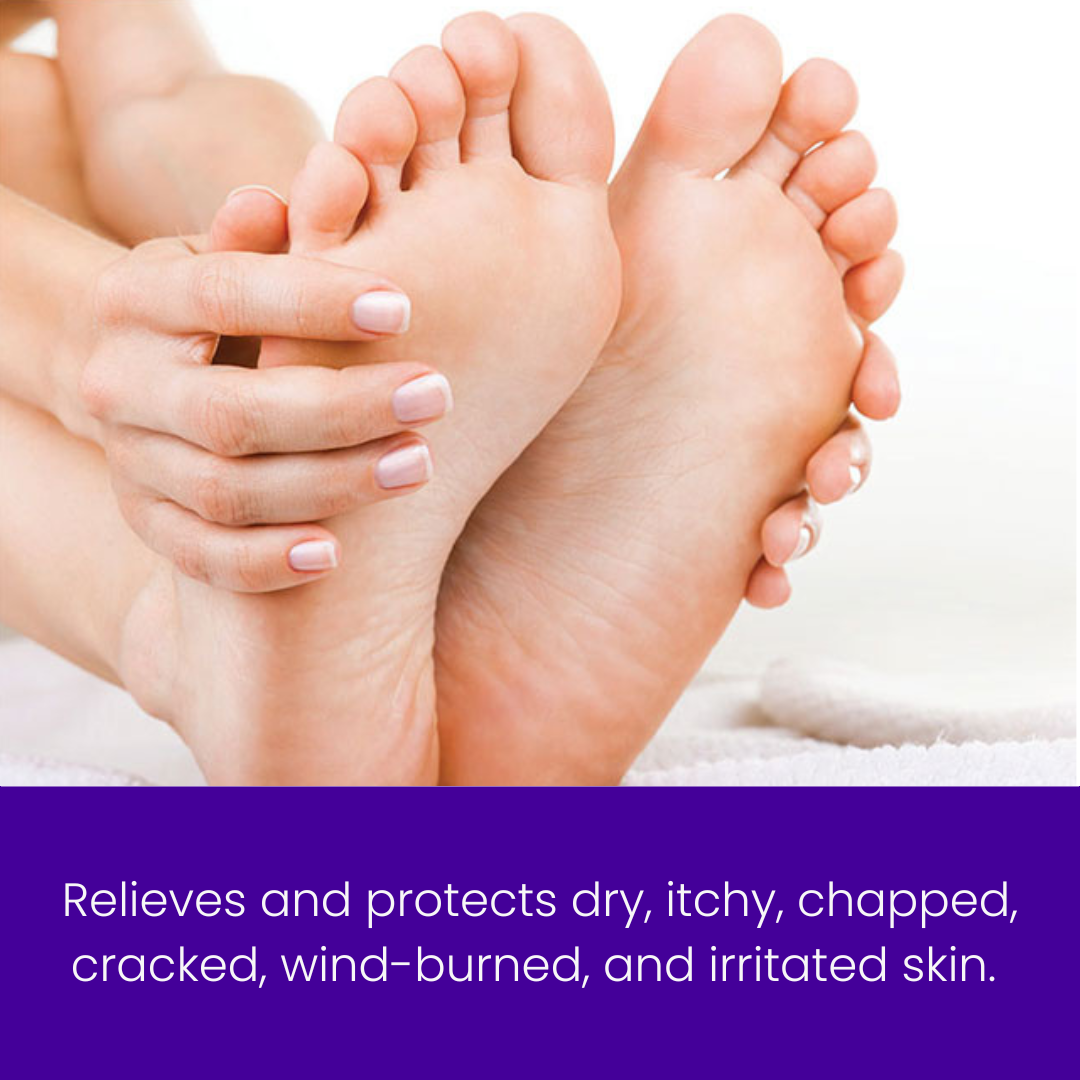 TrueLipids Relieve &amp; Protect Ointment for Dry, Itchy &amp; Eczema-Prone Skin