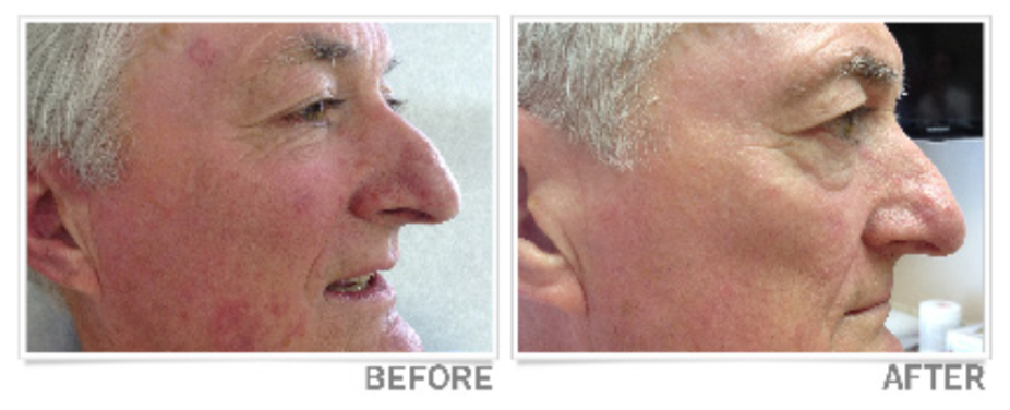 Rejuvenation Package Kit